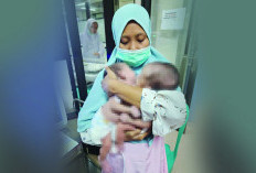 Bayi Kembar Siam Kini Butuh Bantuan Pemkab Cirebon dan Dermawan